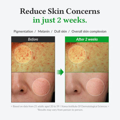 Dr.Althea Post Acne Care Set (Gentle) | 345 Relief Cream & Gentle Vitamin C Serum