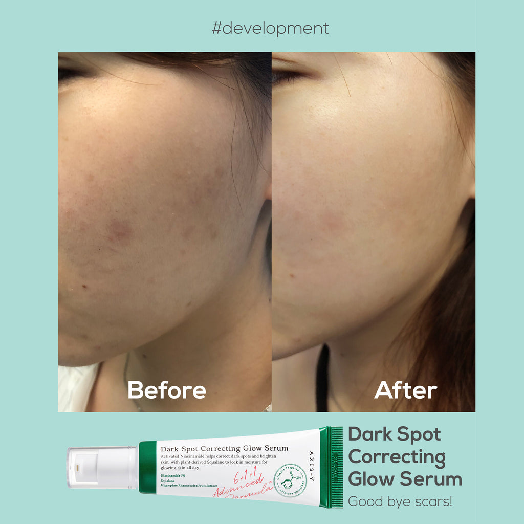 AXIS-Y Dark Spot Correcting Glow serum