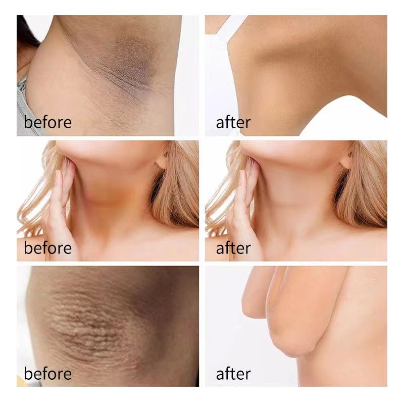 Arm Fair Brightening Cream